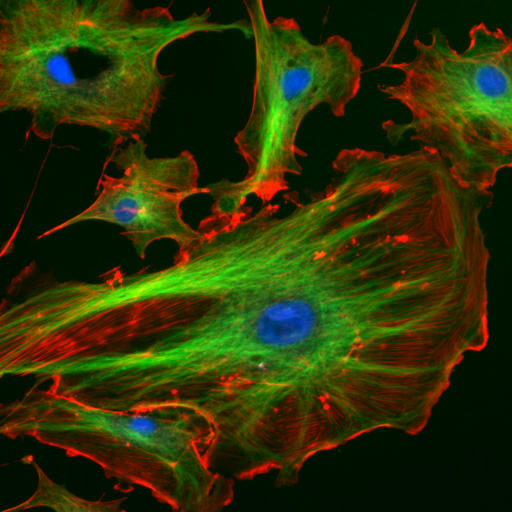 Fluorescence microscopy showing the interior of a cell