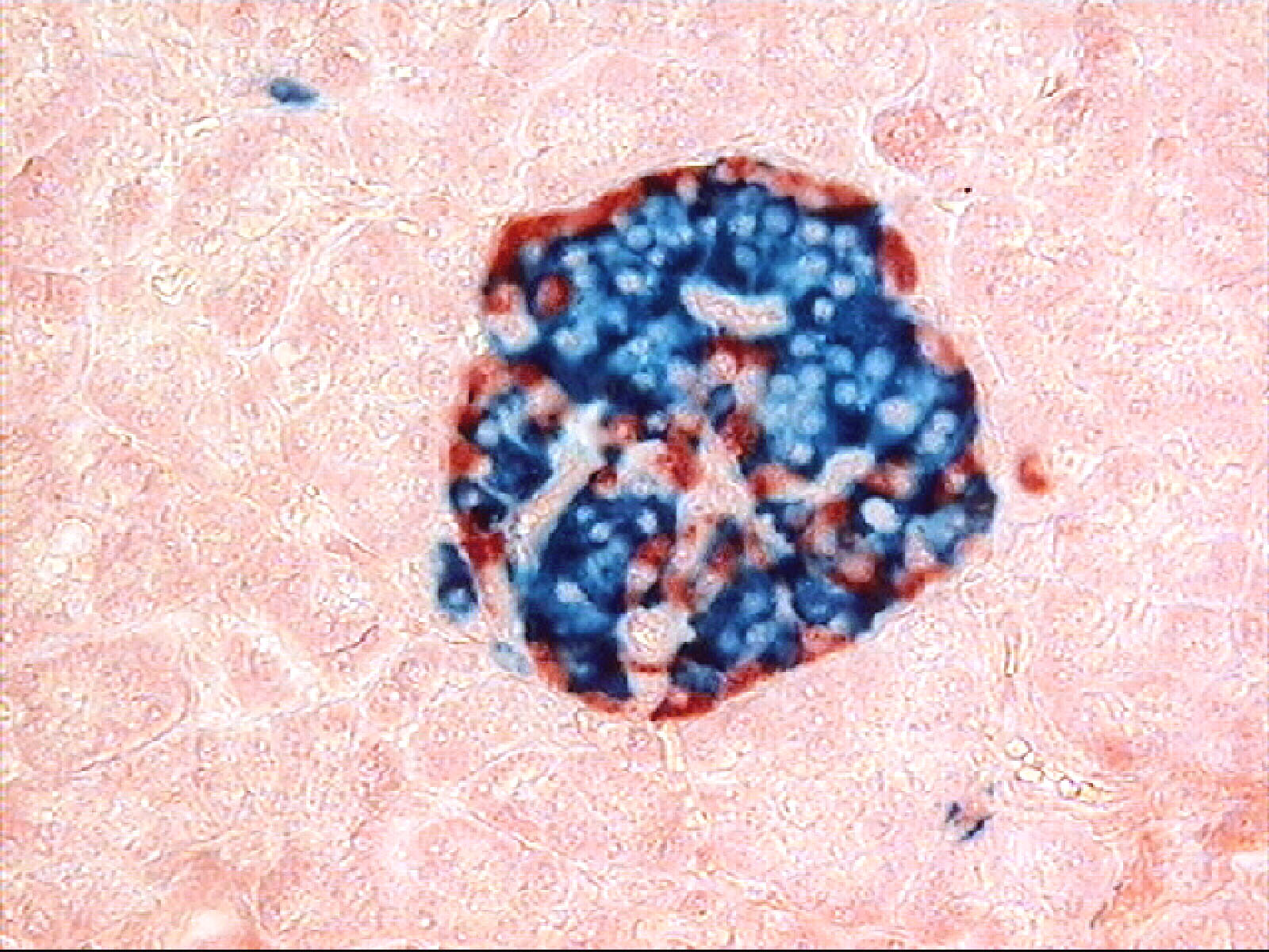 Micrograph of a human pancreatic islet with double immunostaining